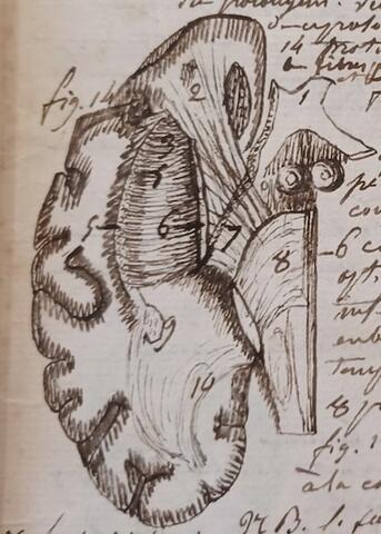 « Leçons de chirurgie pratique et clinique », Papiers de Pierre-Nicolas Gerdy, Ms 5162 (Boîte IV. Mémoires, cours, notes diverses)